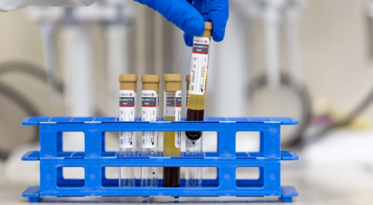 Researchers are continuing to find new ways to treat and detect cancer, photo of DNA test tubes.